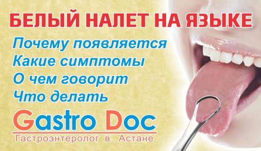 Белый налет на языке - причины со стороны ЖКТ, симптомы и лечение
