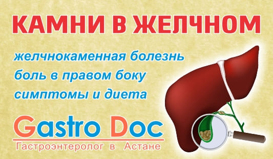 Что такое желчнокаменная болезнь Желчнокаменная болезнь
