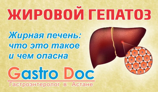 Жировой гепатоз печени